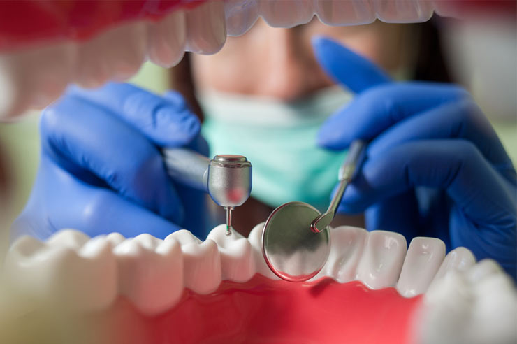 rehabilitacion oral quito