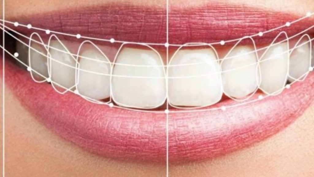 Estetica dental quito