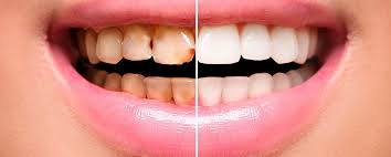 rehabilitación oral